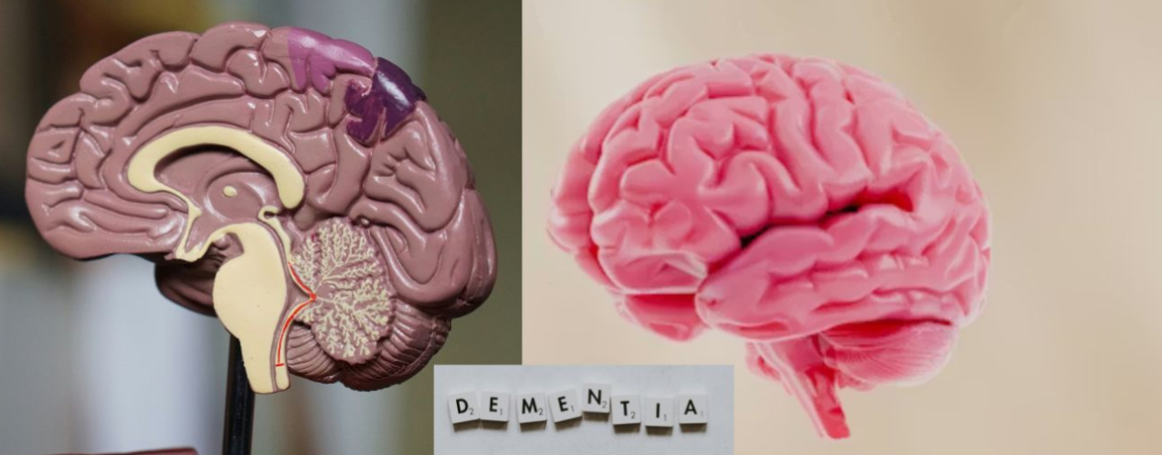 charla demencias